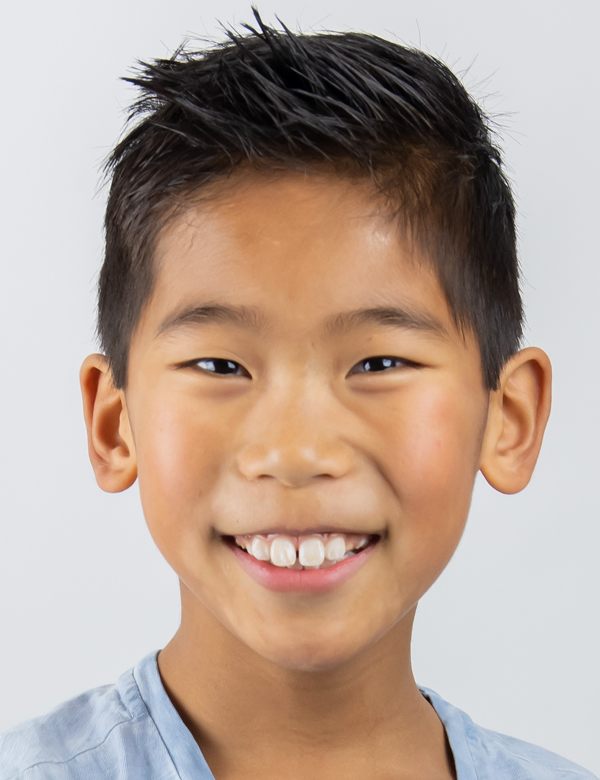 Kindermodel xiao song