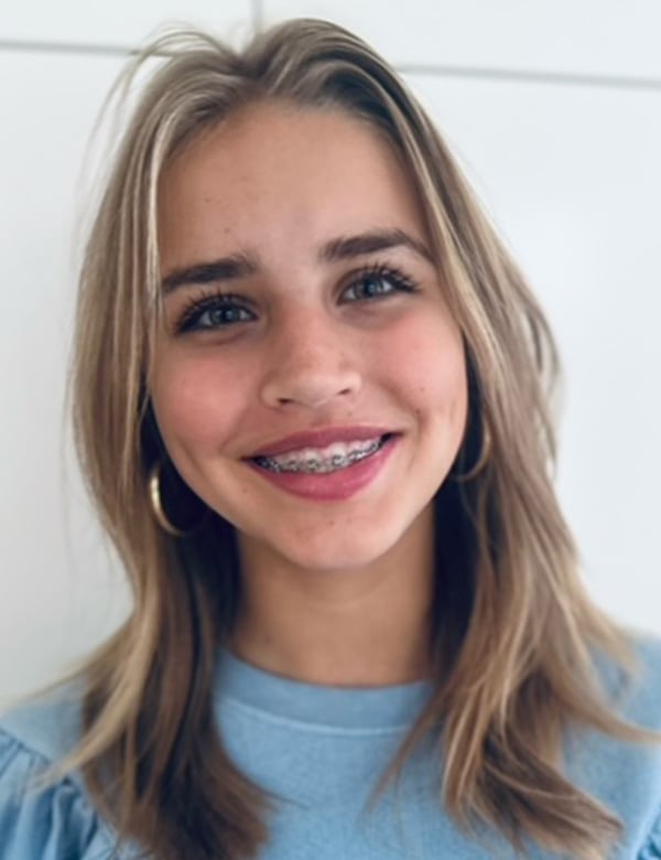 Model Kindermodel blond haar emma